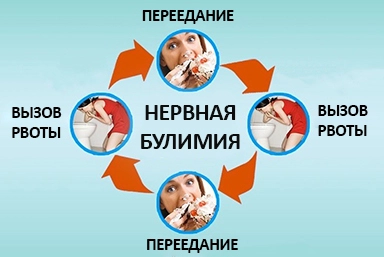 Лечение булимии в Кодинске
